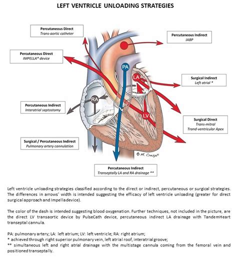 lv venting|left ventricular unloading.